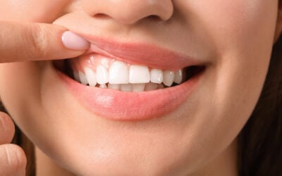 5 Habits for a Healthier Smile All Year Long