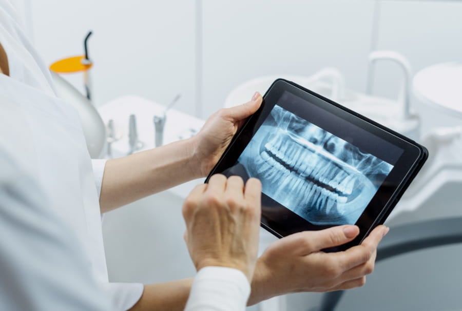 Dental X-Rays in Wilmington, DE